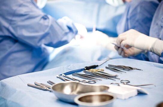 Ang interbensyon sa operasyon sa laygay nga prostatitis